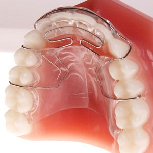 Orthodontic dental retainers