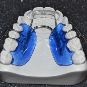 Active dental appliance